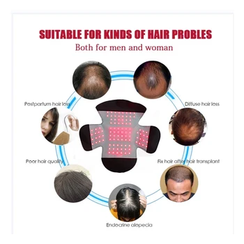 аппарат для лечения выпадения волос, шлем с диодным светодиодным устройством для восстановления волос